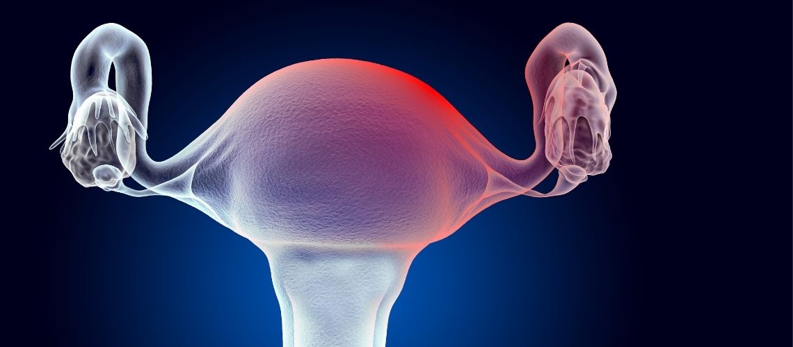 Miyom Ameliyatı Sonrası Tüp Bebek Ne Zaman Yapılır?