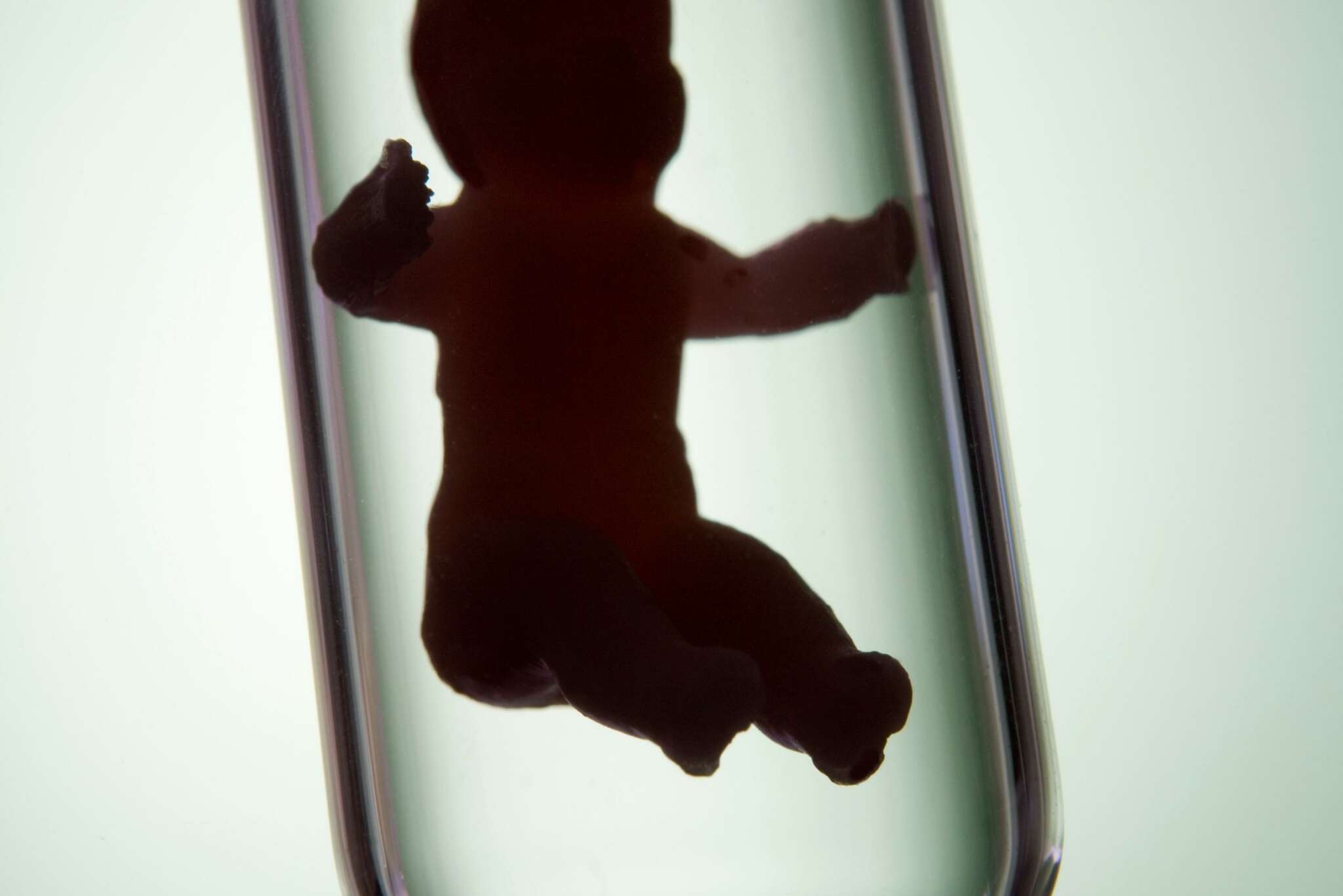 Tüp Bebek İçin En Uygun Zaman Hangisidir?