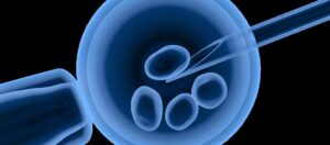 Künstliche Intelligenz bei IVF