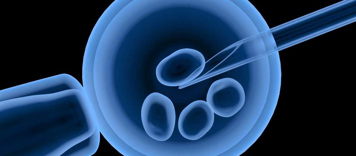 Künstliche Intelligenz bei IVF