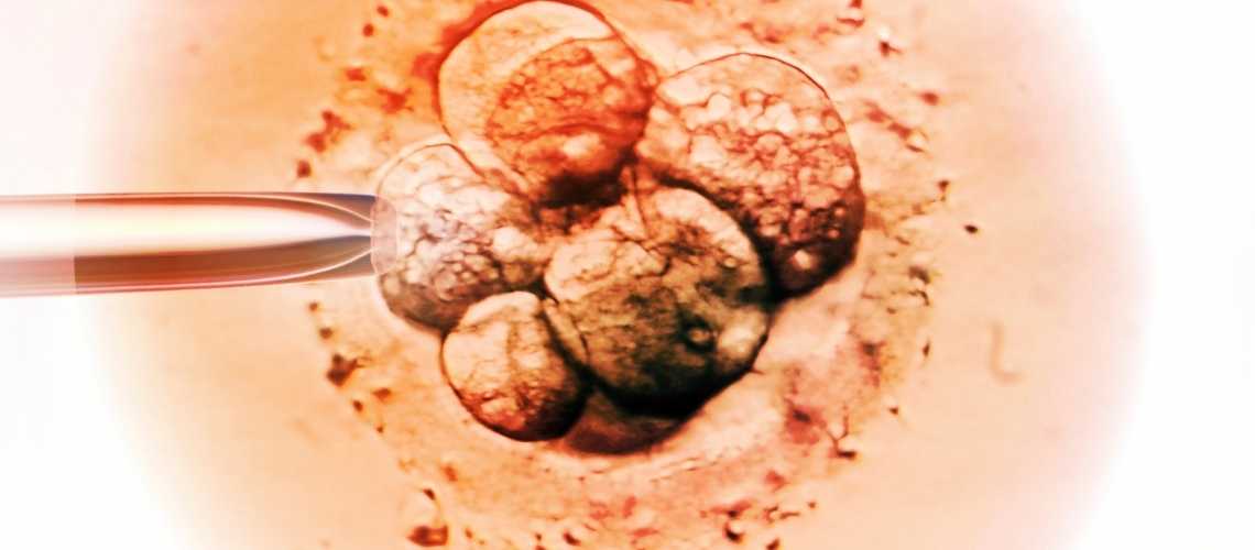 Time-Lapse Inkubation (Embryoscope)