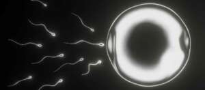 Azoospermia Management Azoospermia Management