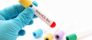 What is a good hCG level for IVF?