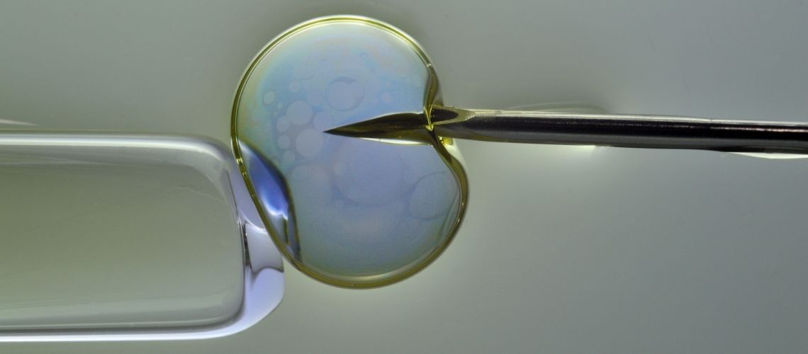 Wie oft kommt es zu Zwillingen bei einer kunstlichen Befruchtung Wie oft kommt es zu Zwillingen bei einer künstlichen Befruchtung?