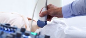 Ikili Test Nedir Nasil ve Ne Zaman Yapilir Что такое двойной тест? Как и когда он проводится?