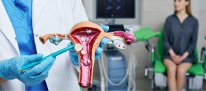 Kapali Miyom Ameliyati Nasil Yapilir Как проводится лапароскопическая миомэктомия?