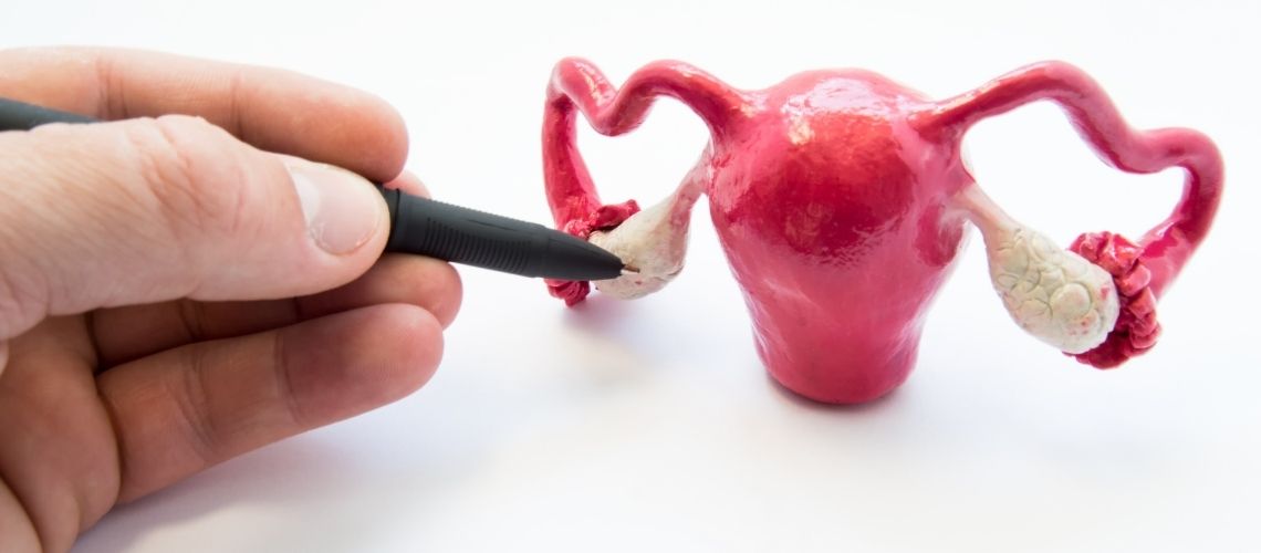 Polikistik Over Sendromu PCOS PKOS Polikistik Over Sendromu (PCOS, PKOS)