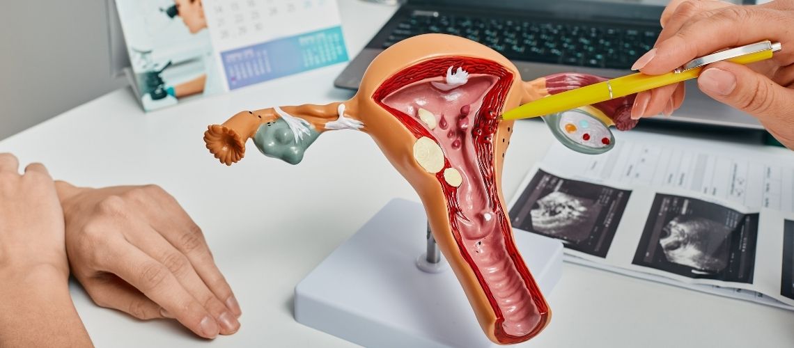 Polip nedir Belirtileri ve tedavi yontemleri nelerdir Что такое полип? Каковы его симптомы и методы лечения?