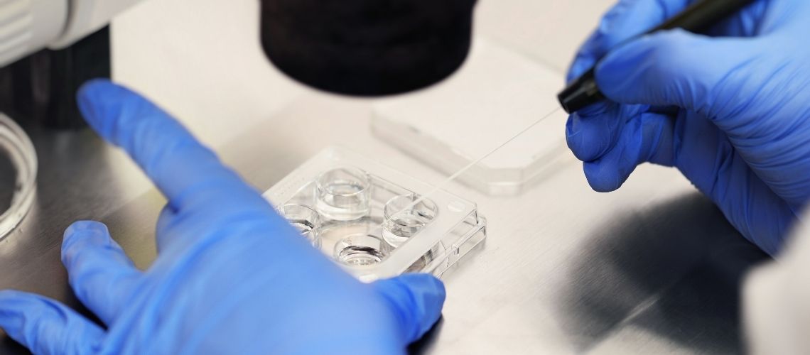 Yumurta Toplama Islemi Nedir Nasil Yapilir Yumurta Toplama İşlemi Nedir, Nasıl Yapılır?