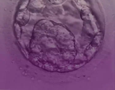BLASTOCYST TRANSFER Anasayfa