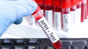 AMH Hormon Testleri