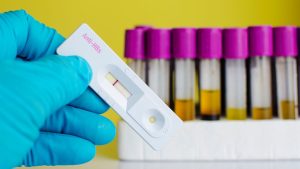 Anti Hbs Ag Seroloji Testleri