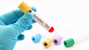 E2Estradiol Hormon Testleri