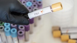 FSH Hormon Testleri