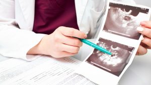 Folikulometri IVF boyunca yapilan yumurta takibiultrason Testler