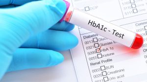 HbA1c Kan Testleri