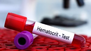 Hematokrit Kan Testleri