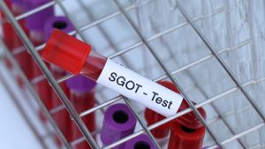 SGOT Kan Testleri