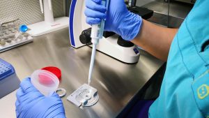 Sperm Analizi Testler