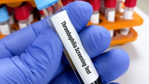 Thrombofili Paneli Testler